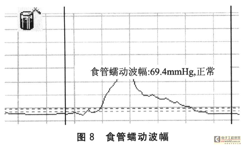 食管蠕動(dòng)波幅