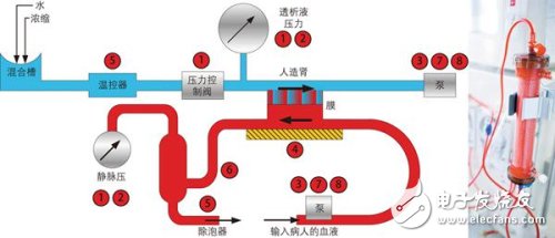 血液透析機要求極其精確地測量患者血壓和透析液（清除血流中的毒素）壓力