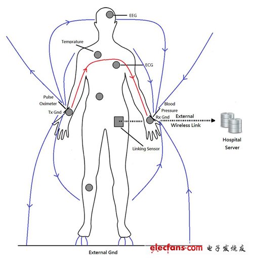 圖1 人體醫(yī)療監(jiān)控網(wǎng)路示意圖
