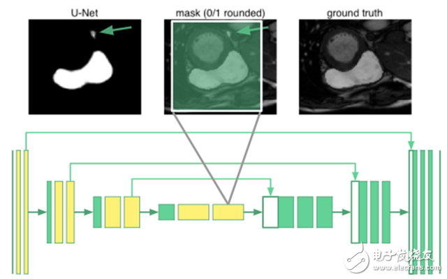 深度學(xué)習(xí)如何進(jìn)行MRI圖像右心室分割