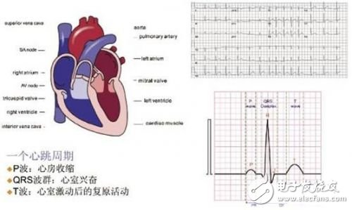 利用ECG AFE簡化病人監(jiān)護(hù)儀設(shè)計(jì)