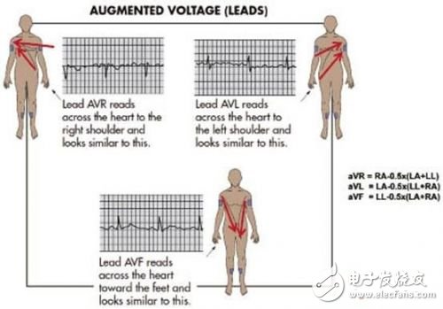 利用ECG AFE簡化病人監(jiān)護(hù)儀設(shè)計(jì)