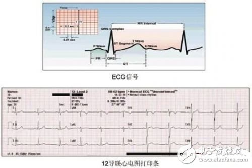 利用ECG AFE簡(jiǎn)化病人監(jiān)護(hù)儀設(shè)計(jì)