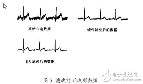 DIY自己的家庭電子醫(yī)療箱 軟硬件設(shè)計方案 （二）前置放大和抗干擾